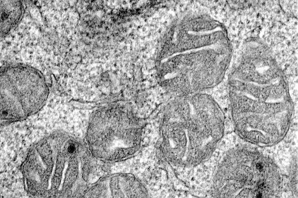An electron microscope image showing the mitochondria inside an erythroid progenitor, the cell that divides to make red blood cells. This image was taken at 50,000x magnification - 70 of these images lined up side-by-side would equal the diameter of a human hair. 