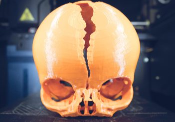 Life-sized, 3D skulls like this one are helping our plastic surgeons provide better patient care and better training for their students.