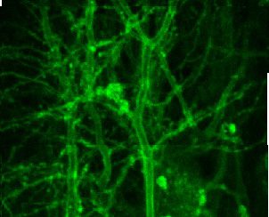 Image of a neurotransmission inside the brain.