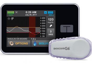 The Control-IQ artificial pancreas system.
