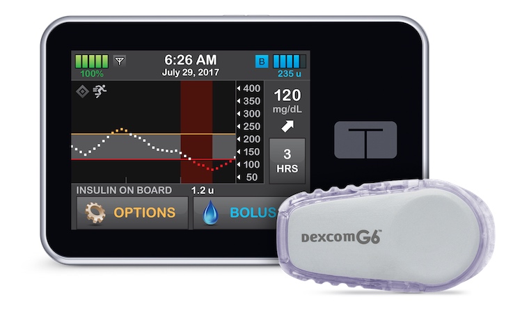 The Control-IQ artificial pancreas system.