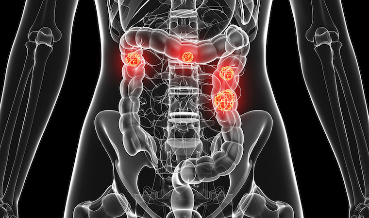 A computer illustration of a colon on a black background.
