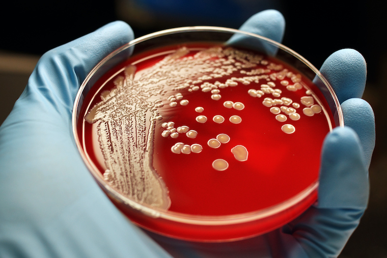 An Innovative Approach to Preventing Antibiotic Resistance
